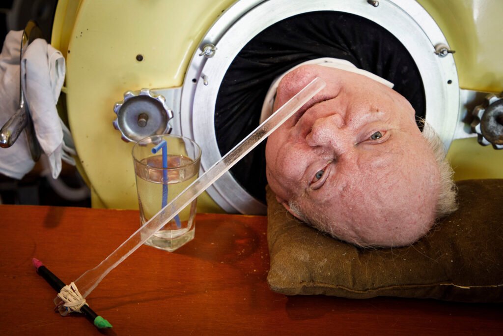 Historic hospital ward filled with iron lungs during the polio epidemic, the type of machines that kept Paul Alexander alive for over 70 years.