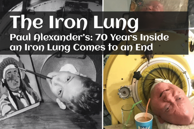 Paul Alexander’s Life and Legacy: 70 Years Inside an Iron Lung Comes to an End